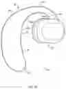 Fig. 09 - Open audio device