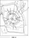 Fig. 03 - Lawnmower String Line Adapter Blade Device