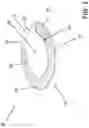 Fig. 02 - MULTI-ZONE HORSESHOE PAD