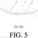 Fig. 06 - Insole Device with Balancing, Correcting, Cushioning and Supporting Functions