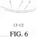 Fig. 07 - Insole Device with Balancing, Correcting, Cushioning and Supporting Functions