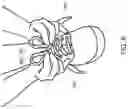 Fig. 07 - METHOD FOR TYING OUTERWEAR TO MINIMIZE UNDESIRED LOOSENING