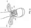Fig. 09 - METHOD FOR TYING OUTERWEAR TO MINIMIZE UNDESIRED LOOSENING