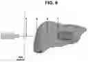 Fig. 10 - ENERGY DELIVERY SYSTEMS AND USES THEREOF