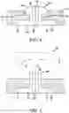 Fig. 04 - TRACHEOSTOMY TUBES AND THEIR MANUFACTURE
