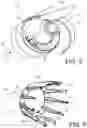 Fig. 04 - Nacelle for a propulsion assembly with a very high bypass ratio, comprising a removable and structural front internal structure