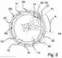 Fig. 03 - Wear pad assembly and method for adjusting