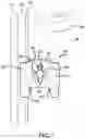 Fig. 02 - Door securement device and method