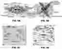 Fig. 06 - Method of storing and retrieving digital pathology analysis results