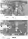 Fig. 07 - Method of storing and retrieving digital pathology analysis results