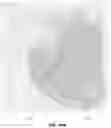 Fig. 15 - Method of storing and retrieving digital pathology analysis results