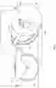Fig. 08 - AGRICULTURAL TRENCH DEPTH SENSING SYSTEMS, METHODS, AND APPARATUS