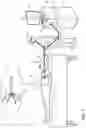 Fig. 02 - ELECTROPHYSIOLOGICAL (EP) MAP POINTS ADJUSTMENTS BASED ON USER CLINICAL INTERPRETATION