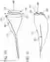 Fig. 08 - LEFT ATRIAL APPENDAGE CLOSURE
