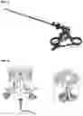 Fig. 02 - LAPAROSCOPIC SURGERY INSTRUMENT NOT REQUIRING TROCAR