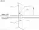 Fig. 04 - LAPAROSCOPIC SURGERY INSTRUMENT NOT REQUIRING TROCAR