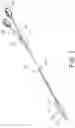 Fig. 02 - BALLOON CATHETER WITH SELECTIVE SCORING FUNCTION