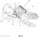 Fig. 09 - BONE ALIGN AND JOINT PREPARATION DEVICE AND METHOD