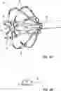 Fig. 03 - HIGH-FREQUENCY TISSUE ABLATION USING COATED ELECTRODES