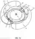 Fig. 15 - INTRAOCULAR LENSES AND PERIPHERAL PORTION STABILIZATION