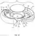 Fig. 17 - INTRAOCULAR LENSES AND PERIPHERAL PORTION STABILIZATION