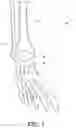 Fig. 02 - WHOLE TALUS IMPLANT AND METHOD
