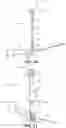 Fig. 07 - METATARSAL ARTHROPLASTY DEVICES, SYSTEMS, AND METHODS