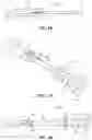 Fig. 09 - METATARSAL ARTHROPLASTY DEVICES, SYSTEMS, AND METHODS