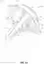 Fig. 02 - METATARSAL ARTHROPLASTY DEVICES, SYSTEMS, AND METHODS