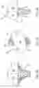 Fig. 09 - Implant and covering methods and apparatus