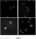 Fig. 06 - METHODS AND COMPOSITIONS FOR TREATING A FIBROTIC DISEASE