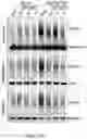 Fig. 43 - COMPOSITIONS AND METHODS FOR PREDICTING THERAPEUTIC OUTCOME