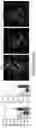 Fig. 136 - TARGETING G3BP AGGREGATION TO PREVENT NEURODEGENERATION