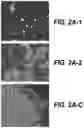 Fig. 05 - IDENTIFICATION OF HLA-RESTRICTED PRAME PEPTIDE EPITOPES, PRAME-SPECIFIC T CELLS SUITABLE FOR 
