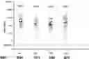 Fig. 01 - Immunogenic compositions for use in pneumococcal vaccines