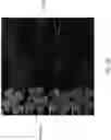 Fig. 03 - NUCLEIC ACID-BASED COMPOSITIONS AND METHODS FOR TREATING SMALL VESSEL DISEASES