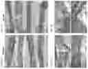 Fig. 05 - NUCLEIC ACID-BASED COMPOSITIONS AND METHODS FOR TREATING SMALL VESSEL DISEASES