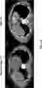 Fig. 49 - ADOPTIVE CELL THERAPY COMBINATION TREATMENT AND COMPOSITIONS THEREOF
