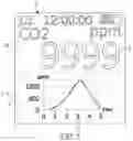 Fig. 06 - Smart wearable device
