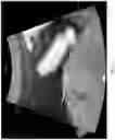 Fig. 04 - Method and system for automatically analyzing placenta insufficiency in a curved topographical ultrasound image slice