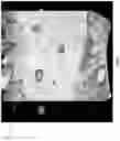 Fig. 06 - Method and system for automatically analyzing placenta insufficiency in a curved topographical ultrasound image slice