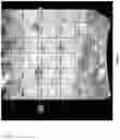 Fig. 07 - Method and system for automatically analyzing placenta insufficiency in a curved topographical ultrasound image slice
