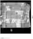 Fig. 08 - Method and system for automatically analyzing placenta insufficiency in a curved topographical ultrasound image slice