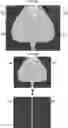 Fig. 05 - IMAGE PROCESSING DEVICE, IMAGE PROCESSING METHOD, AND IMAGE PROCESSING PROGRAM