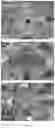 Fig. 02 - Lithium complex oxide