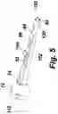 Fig. 04 - Fish hook barb disabler