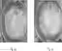Fig. 02 - AGGLOMERATED PROTEIN PRODUCTS AND METHOD FOR MAKING