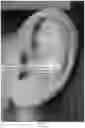 Fig. 49 - Piercing techniques, earrings therefor, and methods of manufacture and use thereof