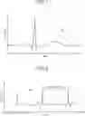 Fig. 02 - MEASUREMENT APPARATUS, MEASUREMENT METHOD, AND NON-TRANSITORY STORAGE MEDIUM