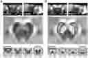 Fig. 01 - USE OF NEUROMELANIN-SENSITIVE MRI AS A BIOMARKER OF DOPAMINE FUNCTION